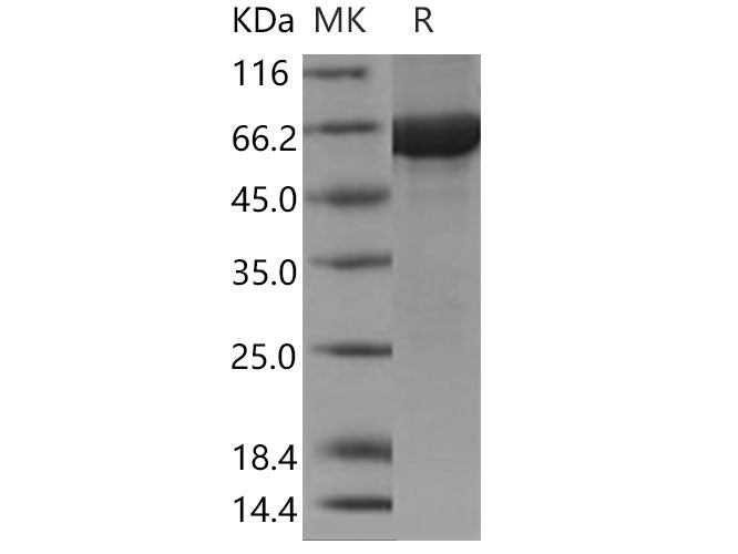Recombinant Human Cbl-c/CBL-3 Protein (His & GST Tag)