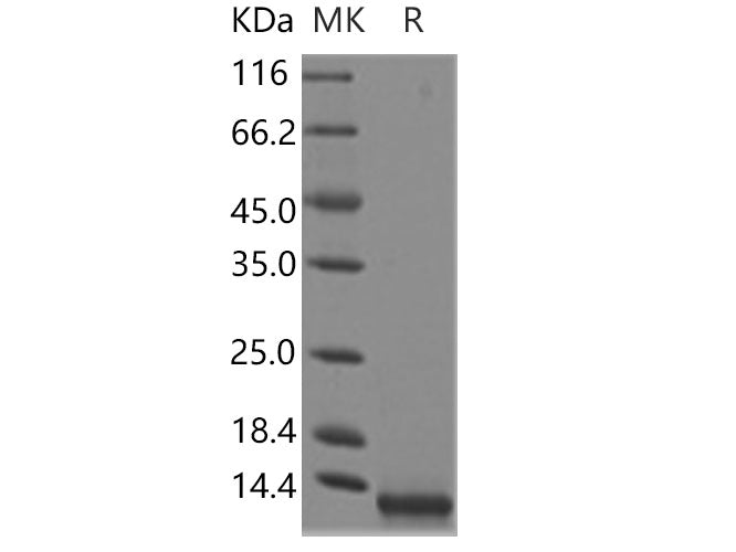 Recombinant Human CCL8/MCP-2 Protein (Yeast, His Tag)