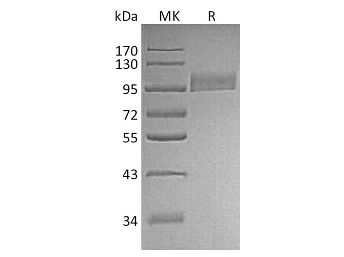 Recombinant Human CD10/Neprilysin Protein (His Tag)