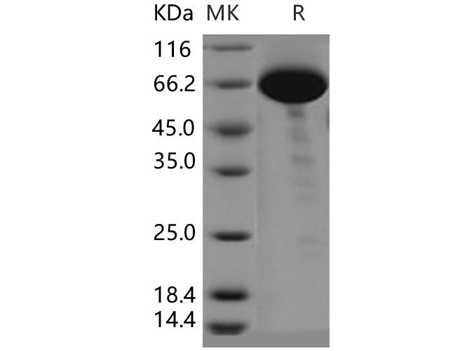 Recombinant Human CD160/BY55 Protein (aa 1-158, His Tag)(Active)
