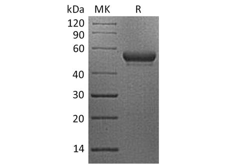 Recombinant Human CD160/BY55 Protein (Fc Tag)