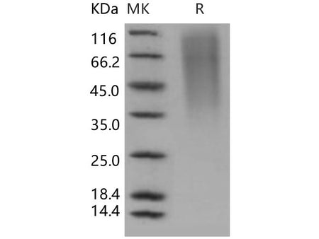 Recombinant Human CD164/Endolyn Protein (His Tag)