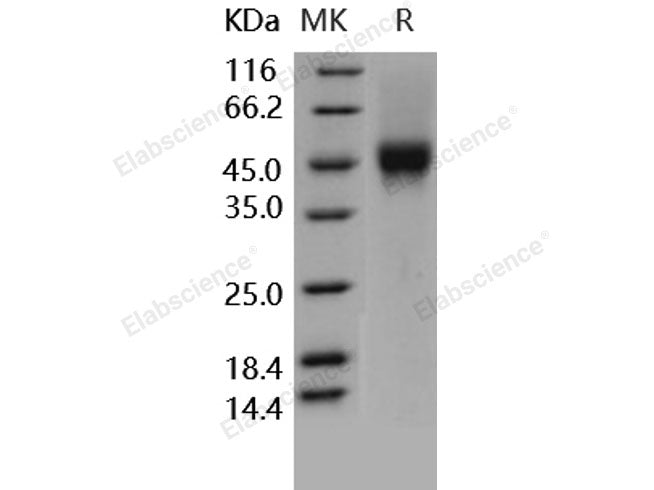 Recombinant Human CD16a/FCGR3A Protein (176 Phe, His&AVI Tag)(Active)