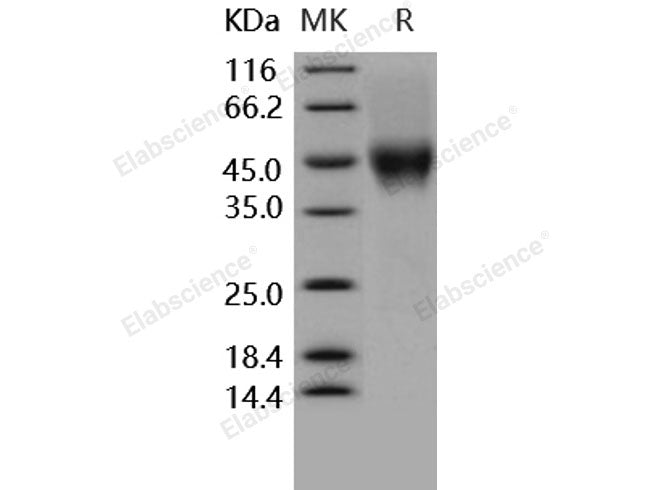 Recombinant Human CD16a/FCGR3A Protein (176 Val, His&AVI Tag)(Active)