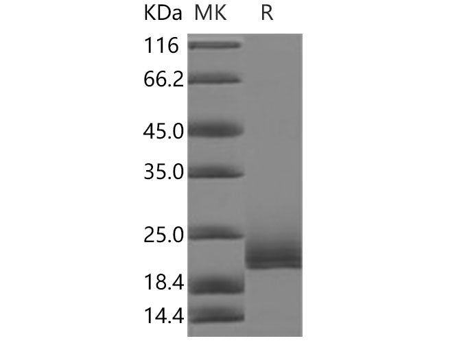 Recombinant Human CD16b/FCGR3B Protein, Biotinylated (Active)