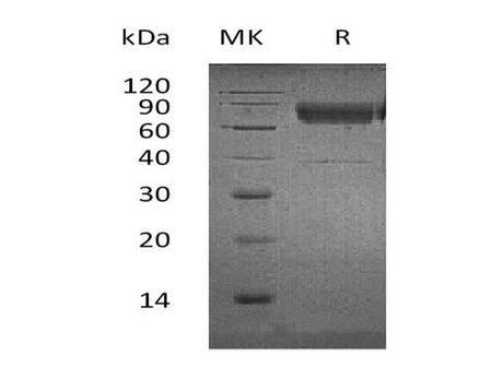 Recombinant Human CD300a/LMIR1 Protein (Fc & His Tag)