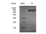 Recombinant Human CD300a/LMIR1 Protein (Fc & His Tag)