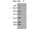 Recombinant Human CD31/PECAM1 Protein