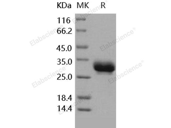 Recombinant Human CD32a/FCGR2A Protein (167 Arg, His Tag)(Active)