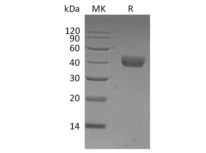 Recombinant Human CD38 Protein (His Tag)