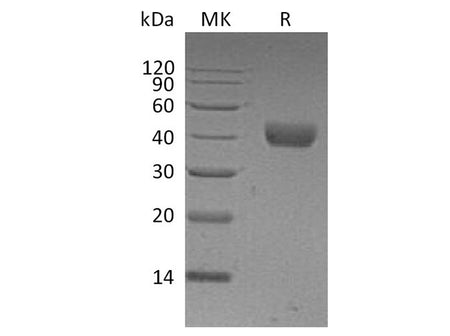 Recombinant Human CD38 Protein (His Tag)