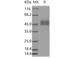 Recombinant Human CD3D & CD3E Heterodimer Protein (Active)