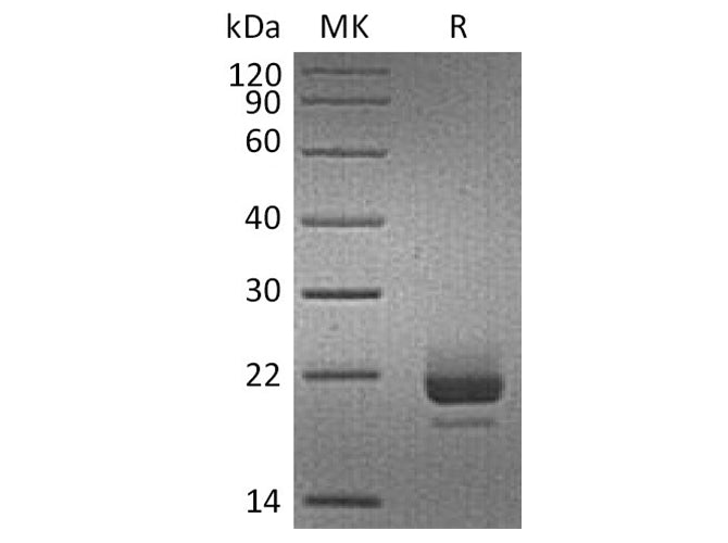 Recombinant Human CD40L/TNFSF5 Protein (His Tag)