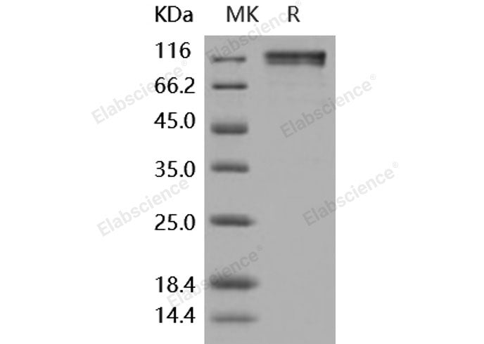 Recombinant Human CD45/PTPRC Protein (Fc Tag)(Active)