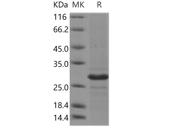 Recombinant Human CD47 Protein (Active)