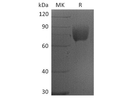 Recombinant Human CD80/B7-1 Protein (mFc Tag)