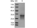Recombinant Human CD82/KAI-1 Protein (His Tag)