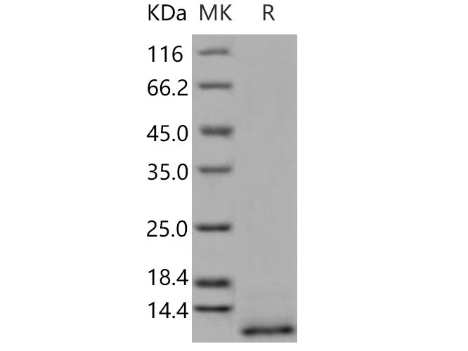 Recombinant Human CD9/Tspan-29 Protein (His Tag)