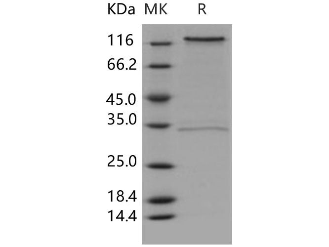 Recombinant Human CD93/C1QR1 Protein (Fc Tag)