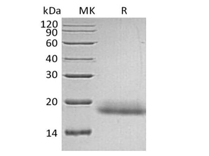 Recombinant Human CD99/MIC2 (C-6His)