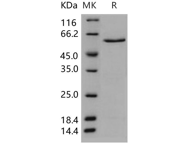 Recombinant Human CDK5 Protein (GST Tag)