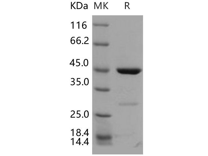 Recombinant Human CDKN2D/p19ink4d Protein (GST Tag)(Active)