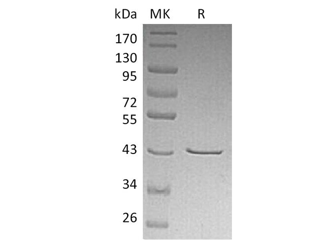 Recombinant Human CHI3L2/YKL-39 Protein (His Tag)