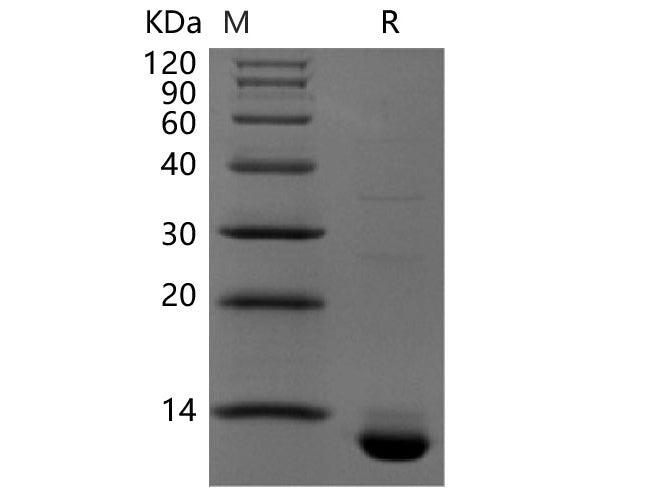 Recombinant Human CLDN18.2(N-6His,C-Avi)