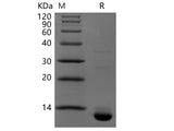 Recombinant Human CLDN18.2(N-6His,C-Avi)