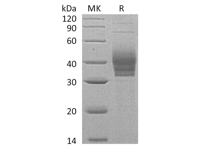 Recombinant Human CLEC4E/Mincel Protein (His Tag)
