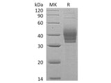 Recombinant Human CLEC4E/Mincel Protein (His Tag)