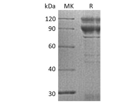 Recombinant Human Coagulation Factor X/F10 Protein (Fc Tag)