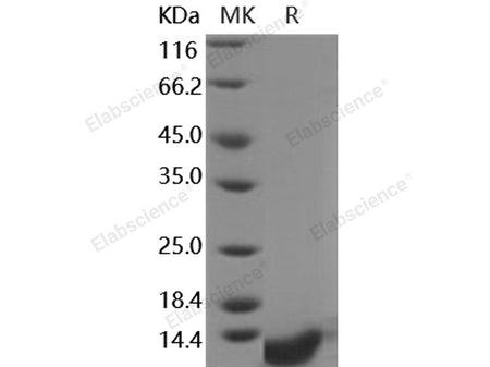 Recombinant Human COL6A3/Collagen-VI Protein