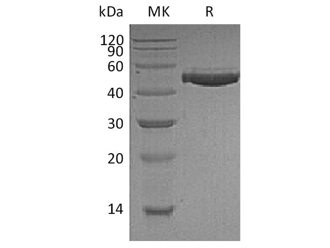 Recombinant Human Complement Factor H/CFH Protein (His Tag)