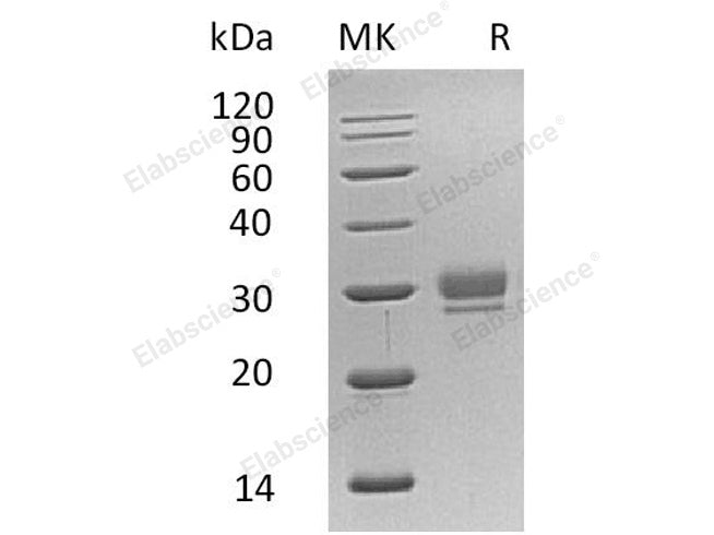 Recombinant Human CTHRC1 Protein (His Tag)