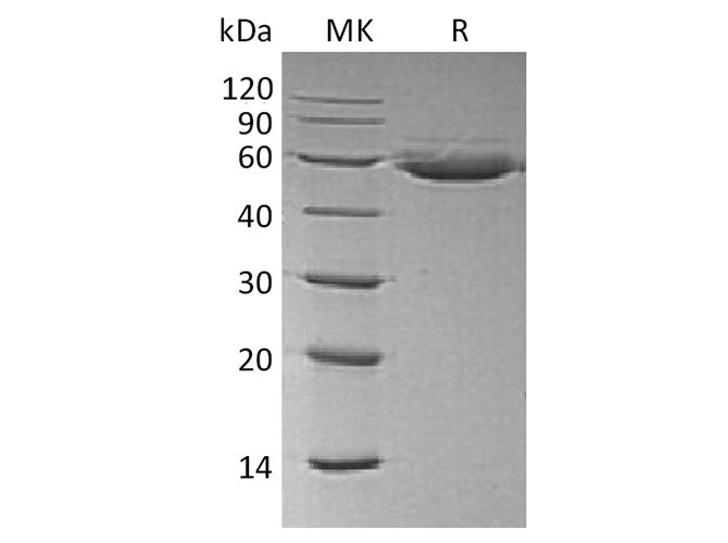 Recombinant Human CTLA4 Protein (Fc & Avi Tag)(Active)