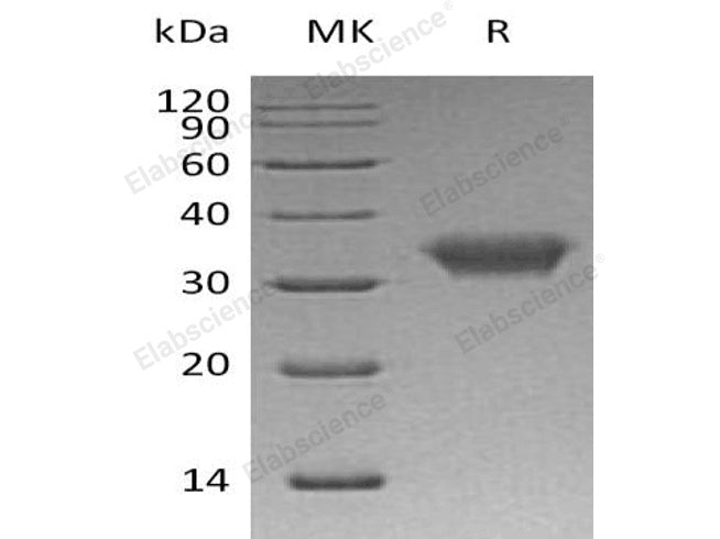 Recombinant Human CXADR/CAR Protein (His Tag)