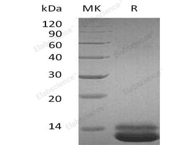 Recombinant Human CXCL1 Protein (His Tag) 