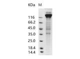 Recombinant Human cytomegalovirus (HCMV) Glycoprotein B / gB Protein (Fc Tag)