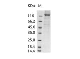 Recombinant Human cytomegalovirus (HCMV) Glycoprotein B / gB Protein (His Tag)