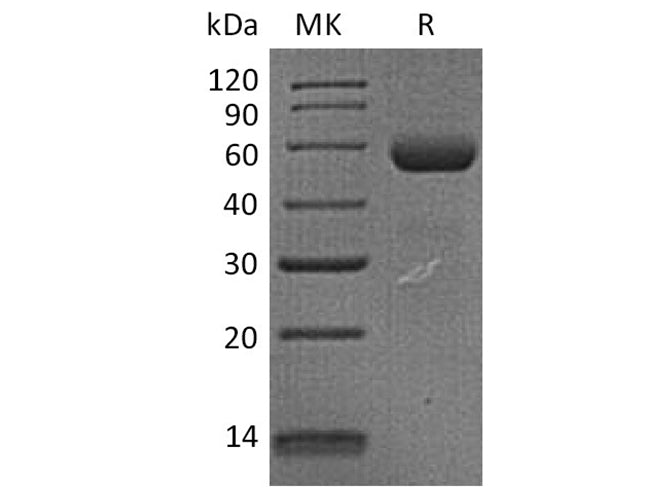 Recombinant Human Dectin-1/CLEC7A Protein (Fc Tag)