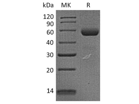 Recombinant Human Dectin-1/CLEC7A Protein (Fc Tag)