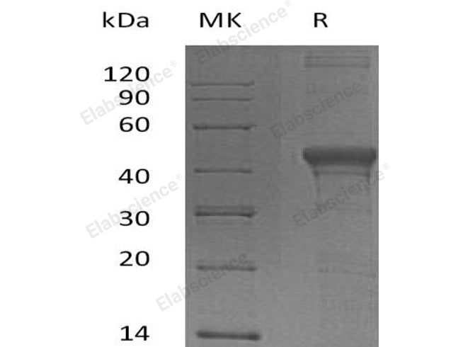 Recombinant Human DFFA Protein (His Tag) 