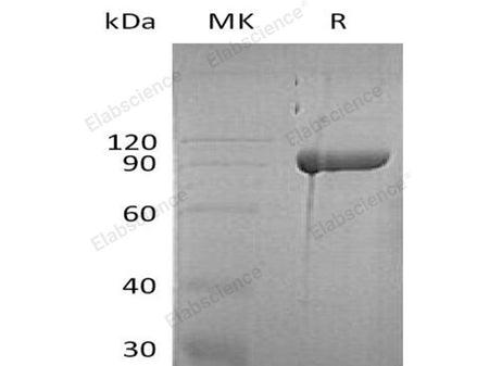 Recombinant Human Diamine Oxidase/AOC1 Protein (His Tag)