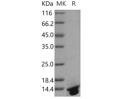 Recombinant Human DNAJC30 Protein (His Tag)