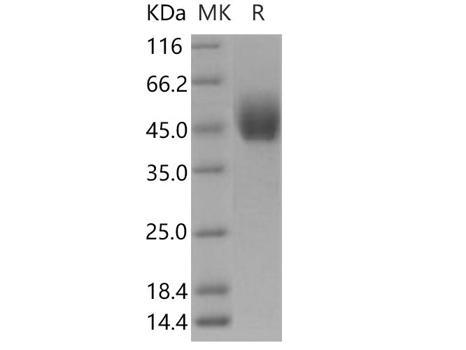 Recombinant Human DPEP2 Protein (Fc Tag)