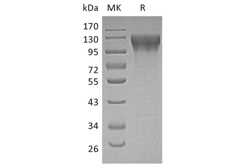Recombinant Human ECE1 Protein (His Tag)