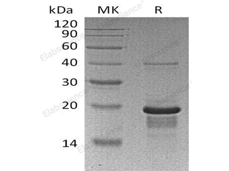 Recombinant Human EGR1 Protein (His Tag) 