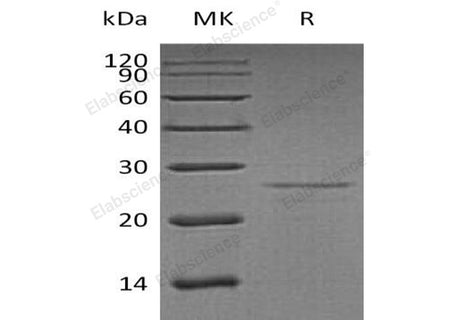 Recombinant Human EIF4E Protein
