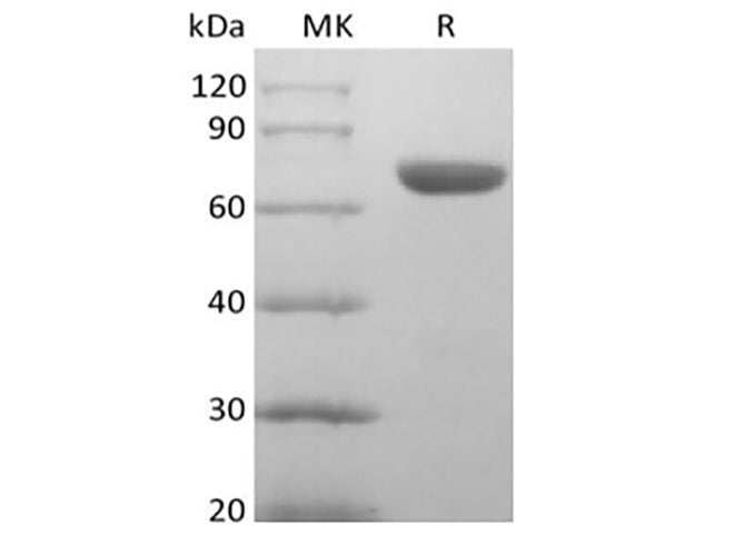 Recombinant Human EphA8 (C-6His)